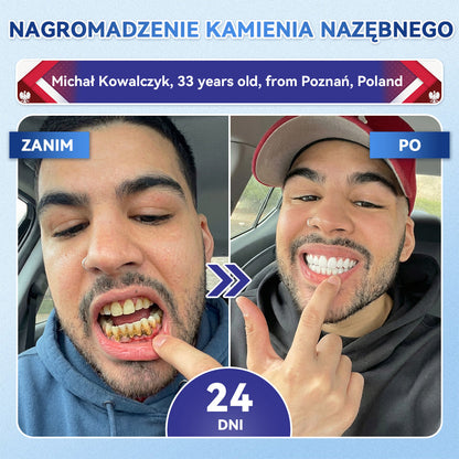 𝐺𝑙𝑖𝑚𝑚𝑒𝑟𝑙𝑦® 𝑇𝑖𝑑𝑒𝑔𝑙𝑢𝑠𝑖𝑏 𝑆𝑧𝑦𝑏𝑘𝑜 𝑟𝑜𝑧𝑝𝑢𝑠𝑧𝑐𝑧𝑎𝑙𝑛𝑒 𝑝𝑎𝑠𝑘𝑖 𝑑𝑜𝑢𝑠𝑡𝑛𝑒 𝑑𝑜 𝑟𝑒𝑔𝑒𝑛𝑒𝑟𝑎𝑐𝑗𝑖 𝑧ę𝑏ó𝑤 𝑖 𝑑𝑧𝑖ą𝑠𝑒ł   口溶贴片 波兰（副本）